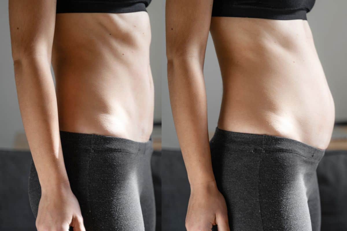 How long does diastasis recti take to improve Brixton?