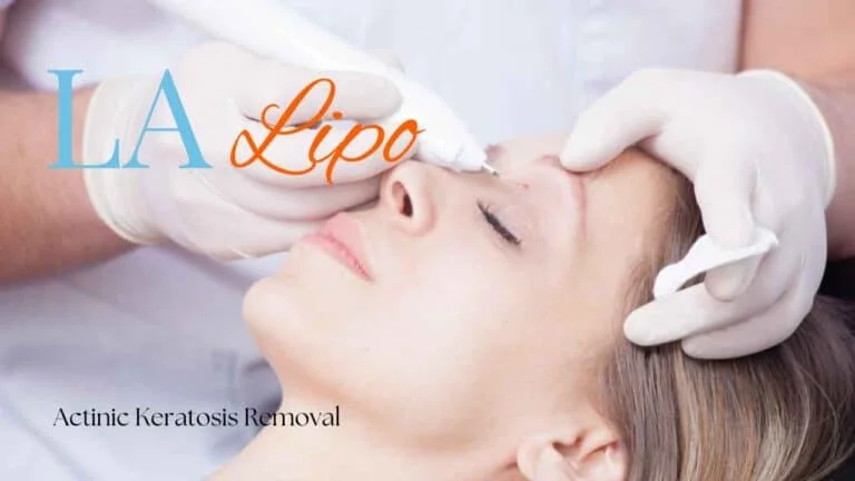 Woman receiving Actinic Keratosis Removal Treatment Brixton