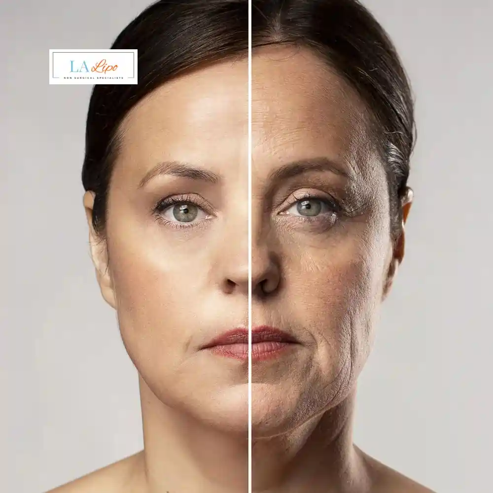 How Can You Tell If Non-Surgical Skin Tightening Is Right for You Brixton?