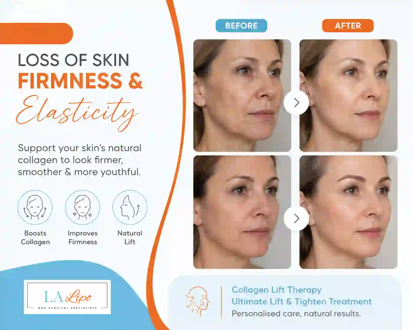 Sign #7: Loss of Skin Firmness and Elasticity Brixton